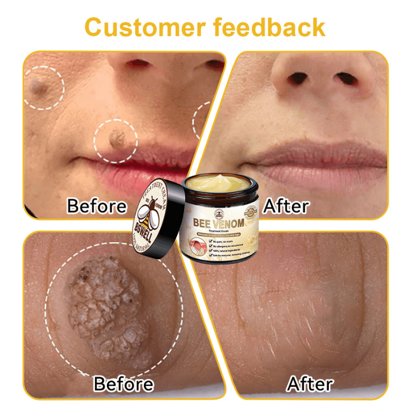 VenomSkin™ All-in-One Cream