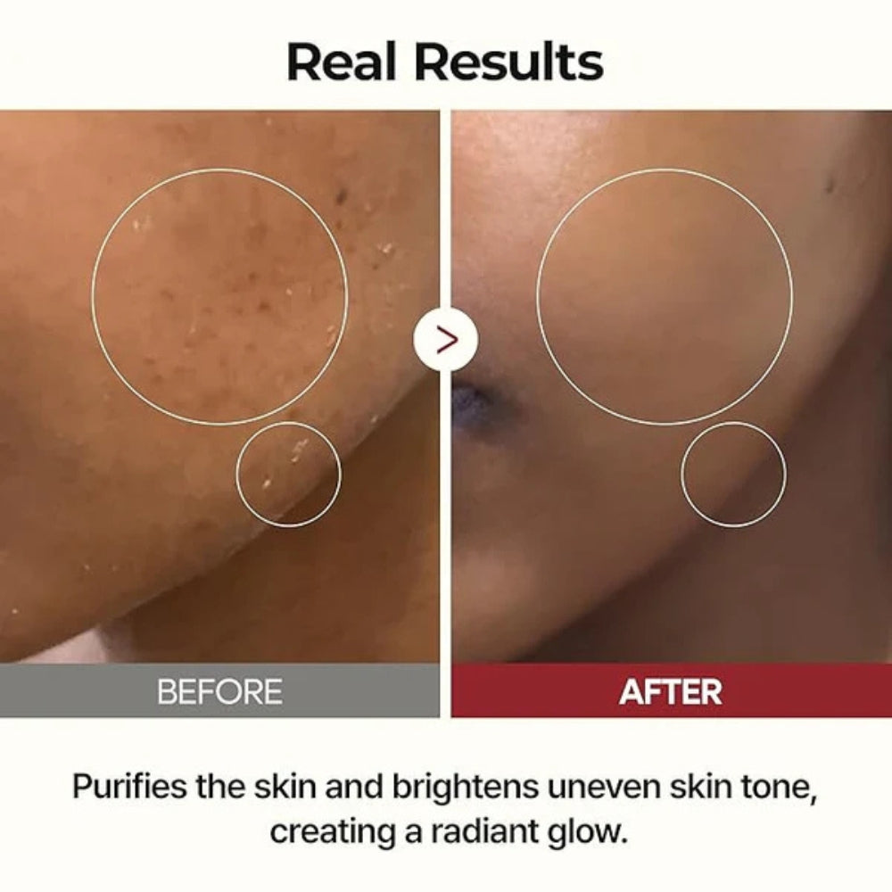 Dr Melaxin™ Peel Shot Ampoule