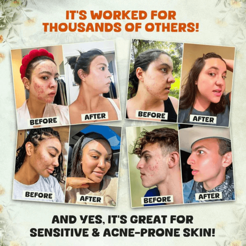 Organic Whipped Tallow & Manuka Honey Balm