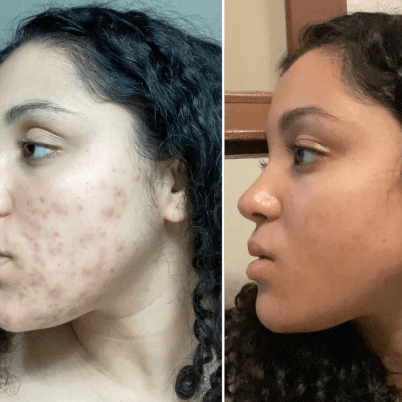 Organic Whipped Tallow & Manuka Honey Balm