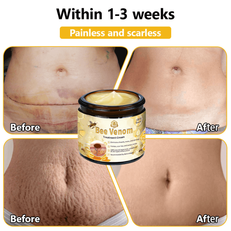 VenomSkin™ All-in-One Cream