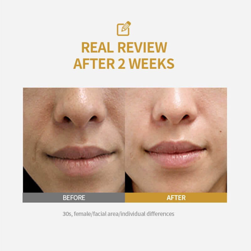Fiorellana™ – Silk Peptide Intensive Collagen Ampoule