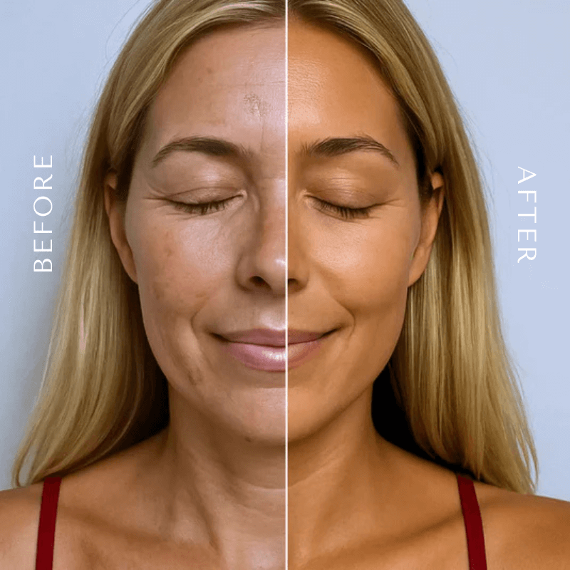 Frumosa Tanning Gummies