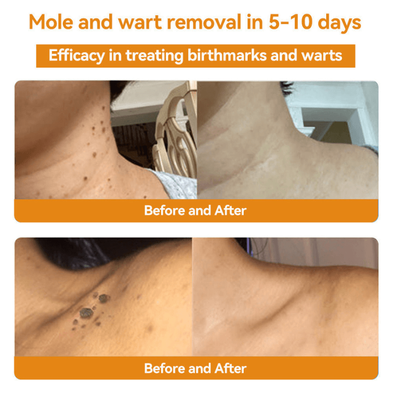 VenomSkin™ All-in-One Cream